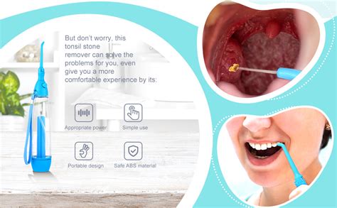 water irrigator for tonsil stones